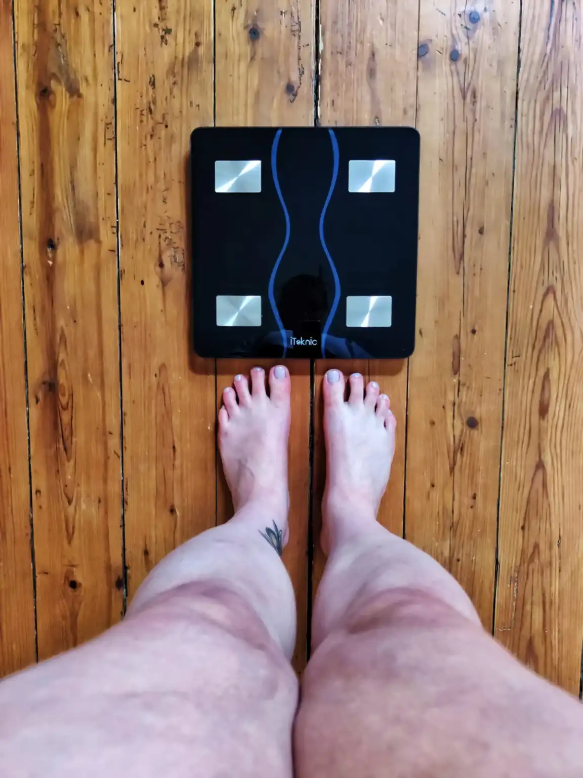 Abnehmen mit Lipödem – 30 kg leichter