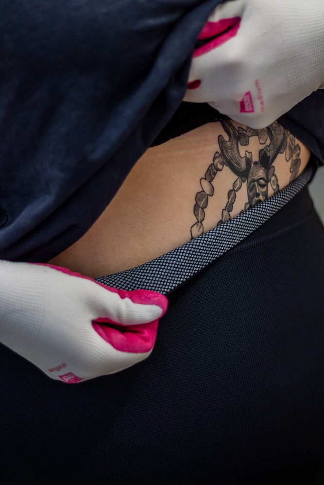 Tattoo am Bauch, darunter Kompression, Lipödem